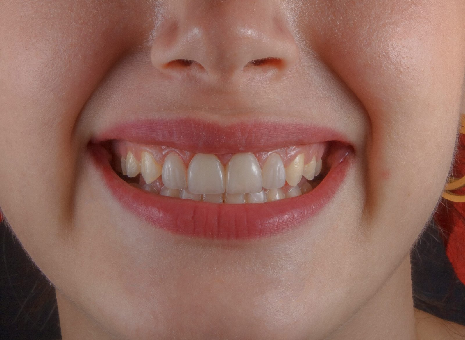HelloTeeth Dental Care